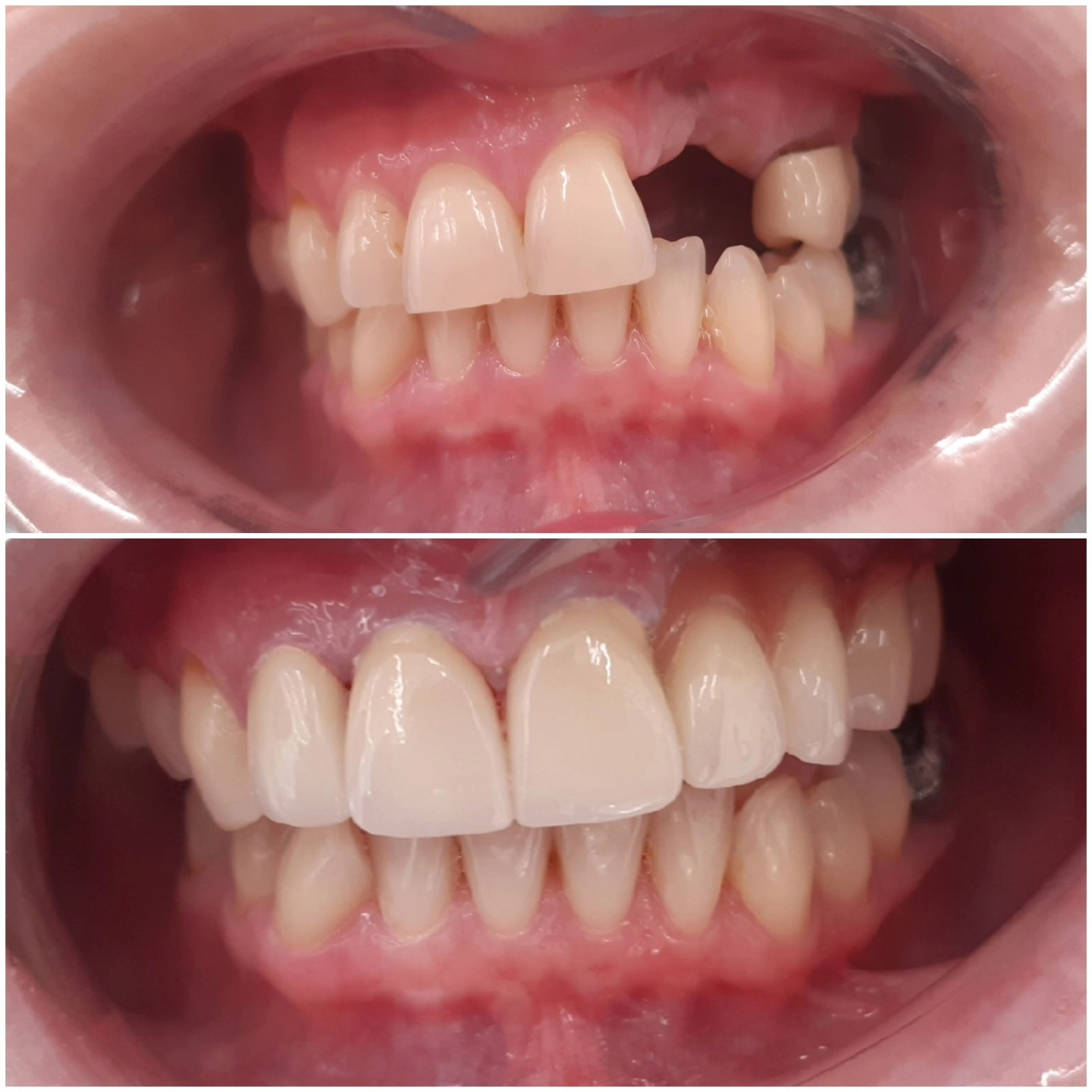 Dental work example 1