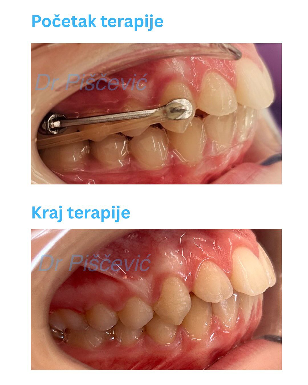 Dental work example 2