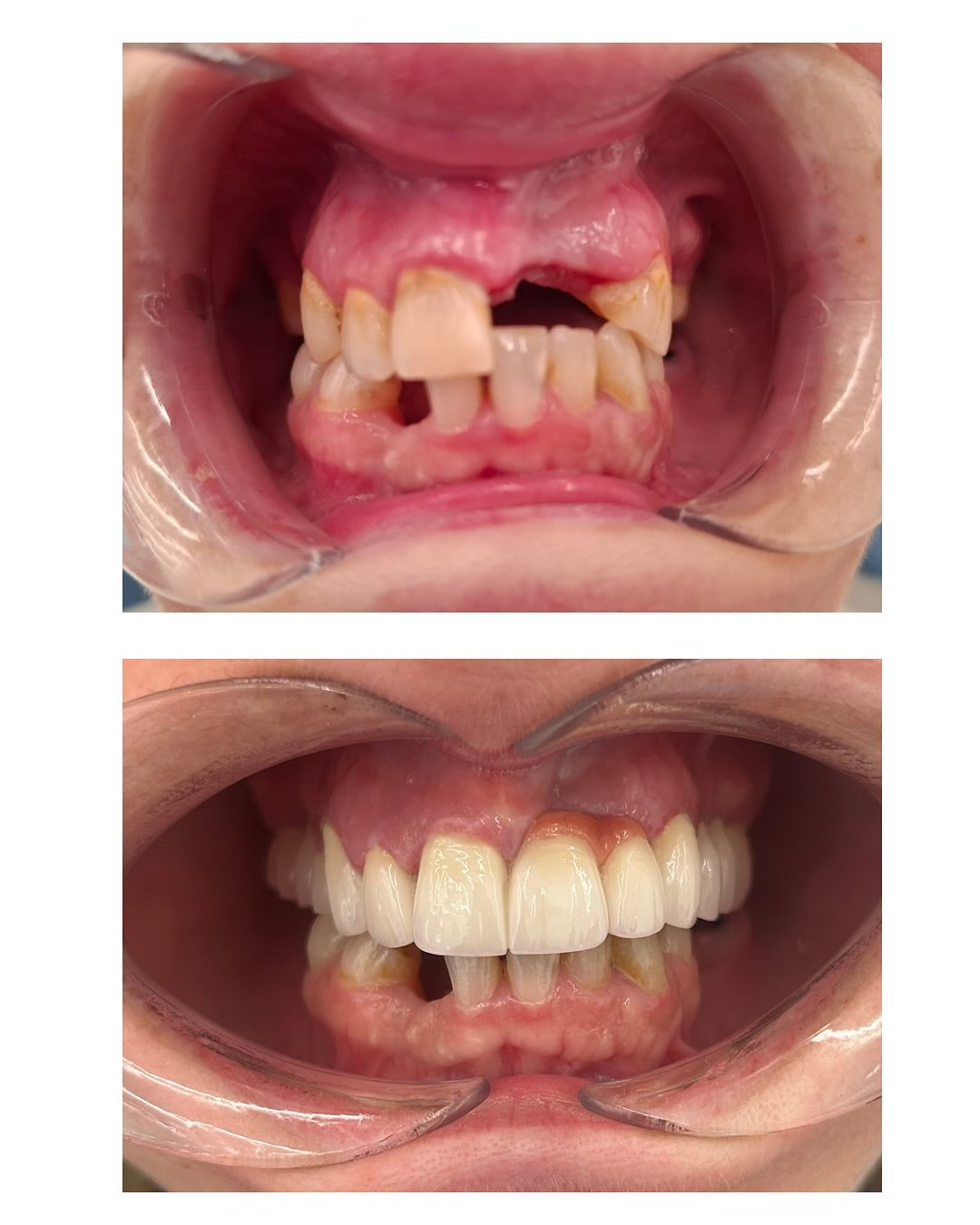 Dental work example 3