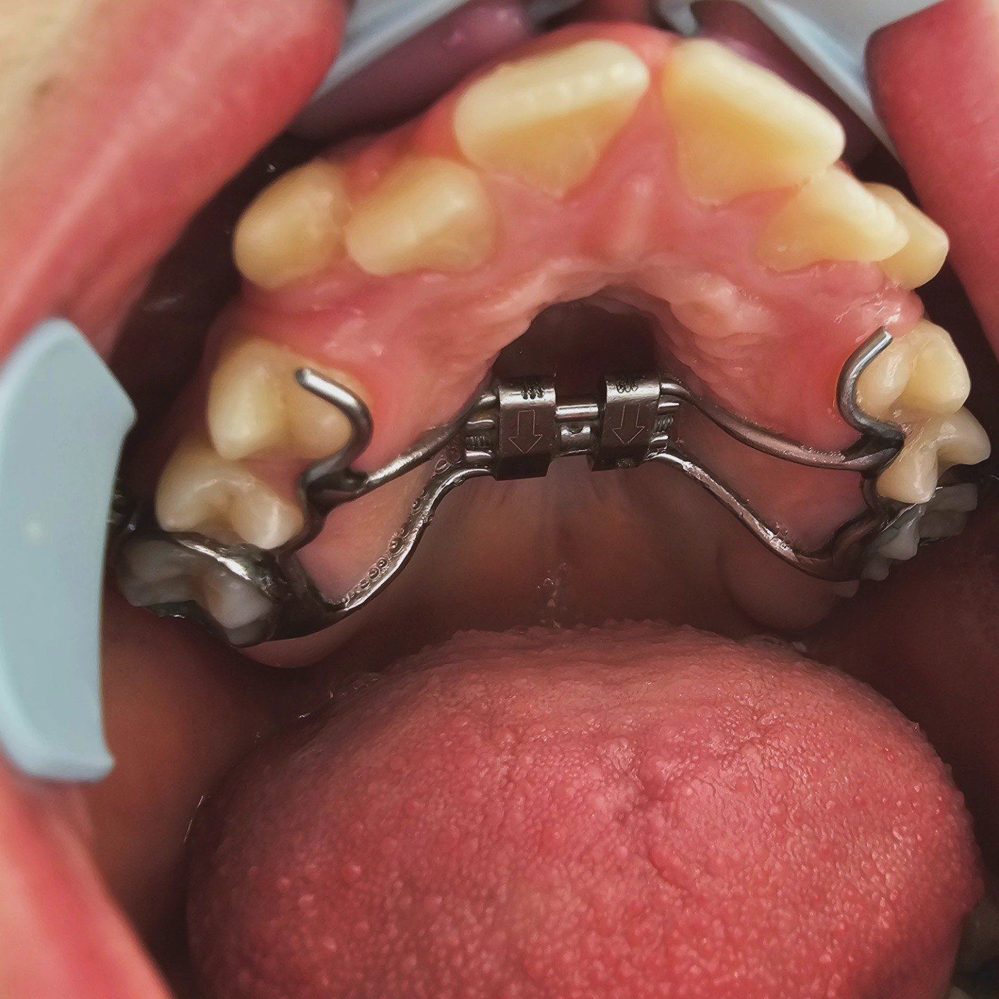 Dental work example 4